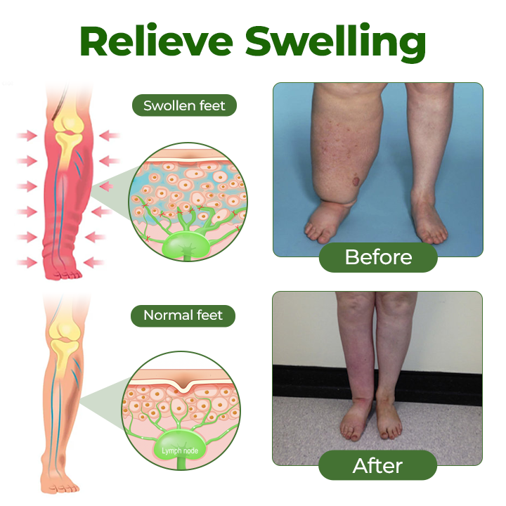 Timilk® Professional Leg Circulation Cream -