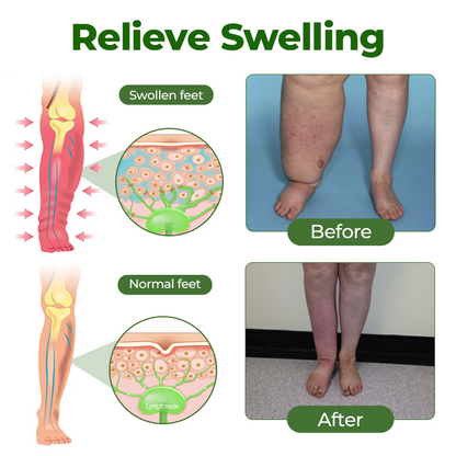 Timilk® Professional Leg Circulation Cream -